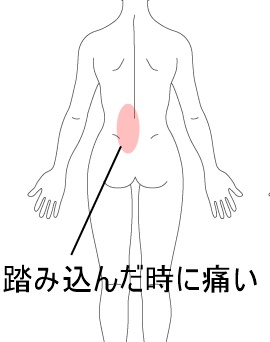 腰 の 痛み 後ろ 左