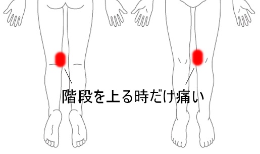 H28.12膝痛