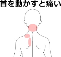 頸や肩の凝り 痛みの症例 鍼灸 はりきゅう 室 楽 静岡県浜松市中区寺島町