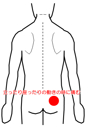 妊娠中の腰痛 坐骨神経痛の症例 ページ 2 鍼灸 はりきゅう 室 楽 静岡県浜松市中区寺島町