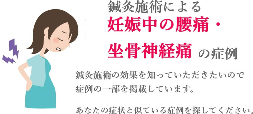 妊娠中の腰痛 坐骨神経痛の症例 鍼灸 はりきゅう 室 楽 静岡県浜松市中区寺島町