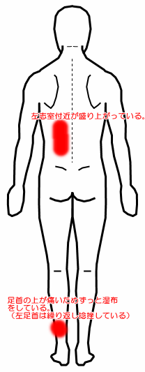 ズキズキ 痛い が 腰