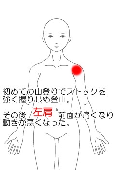 左肩の痛み