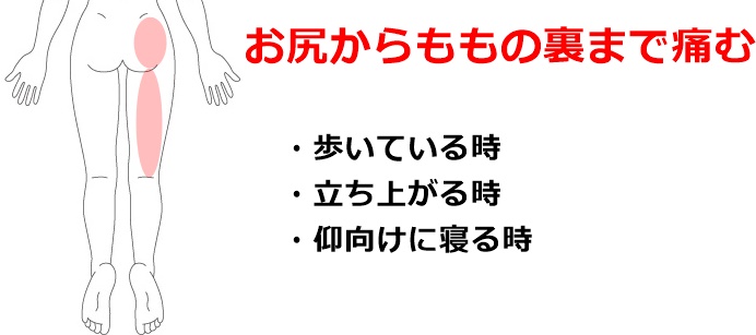 妊娠中の腰痛 坐骨神経痛の症例 鍼灸 はりきゅう 室 楽 静岡県浜松市中区寺島町