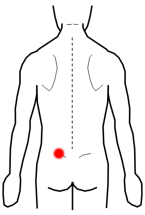 慢性腰痛４