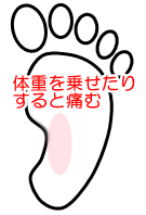 foot_l
